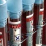 Παγκόσμια Ημέρα HIV και AIDS (1η Δεκεμβρίου): Μείωση των νέων μολύνσεων και των θανάτων