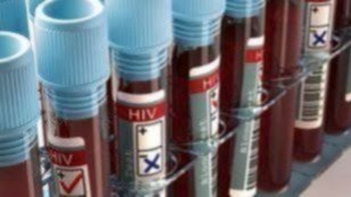 Παγκόσμια Ημέρα HIV και AIDS (1η Δεκεμβρίου): Μείωση των νέων μολύνσεων και των θανάτων